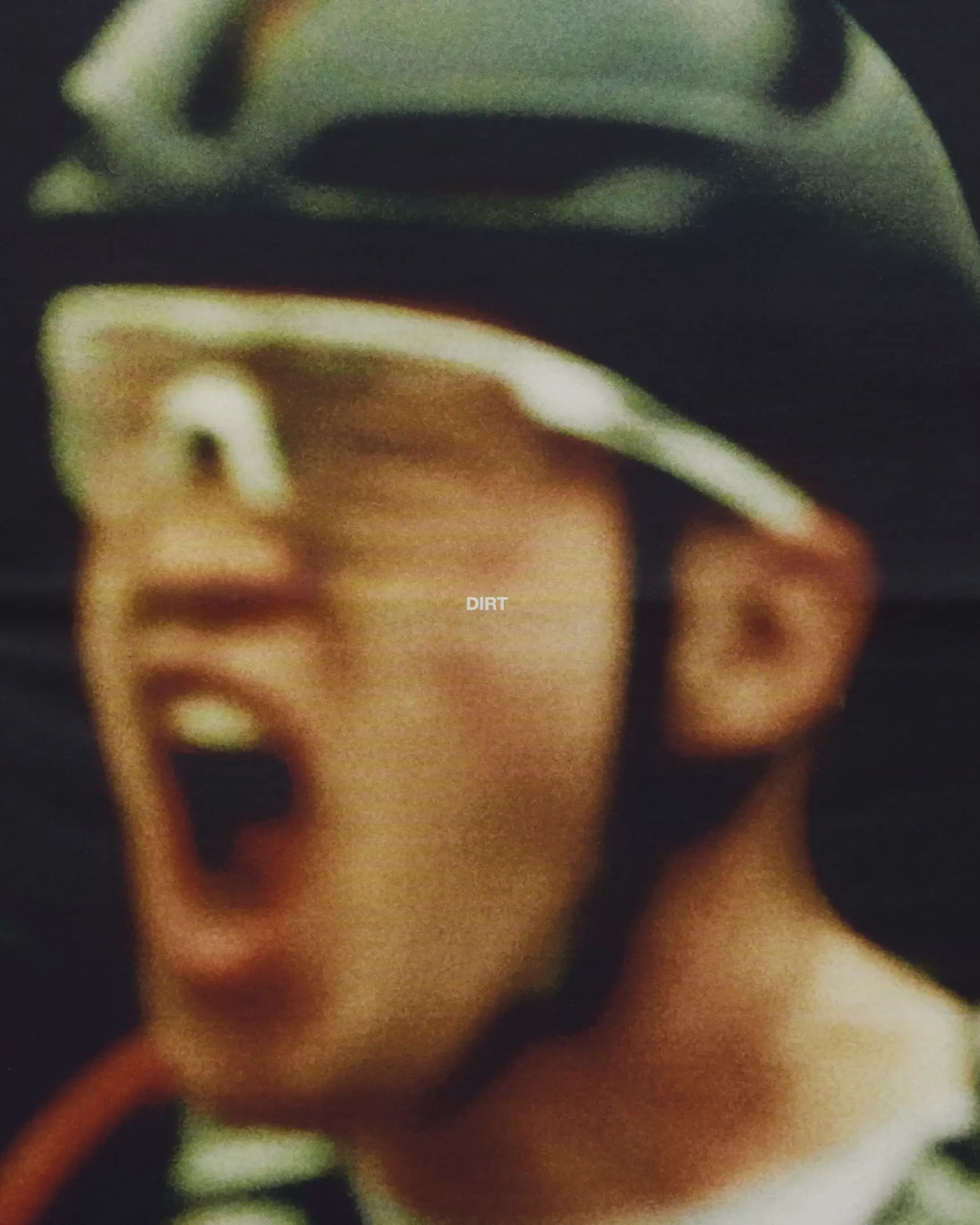 DIRT